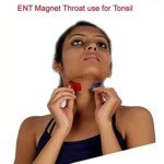 ACCUPRESSURE ENT MAGNET1234