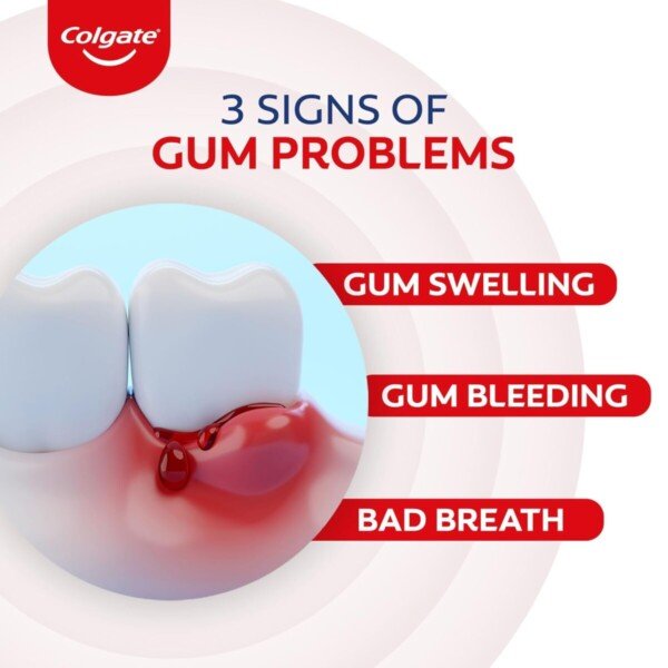 Colgate PerioGard Gum Care Toothpaste1