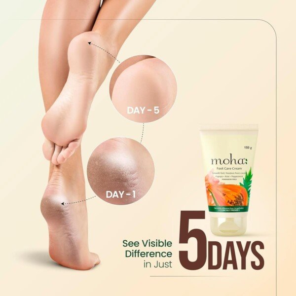 Applying Moha cracked heel cream to dry rough feet overnight nourishment heel repair for men and women