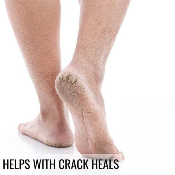 Epsom salt 1kg price pharma grade bath soak foot detox muscle recovery magnesium sulfate unscented